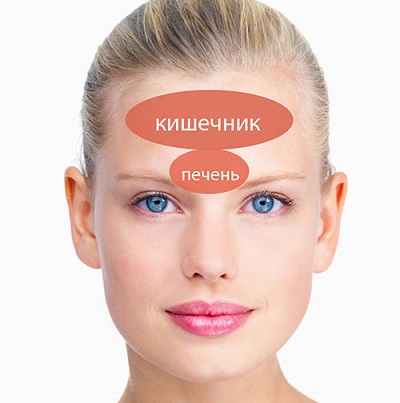 О заболеваниях каких органов свидетельствуют прыщи на лбу