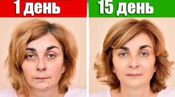 Система ухода за кожей лица. Корейская система ухода.