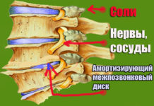 Что такое отложение солей в позвоночнике. Чем они опасны? Что такое отложение солей в позвоночнике. Чем они опасны?